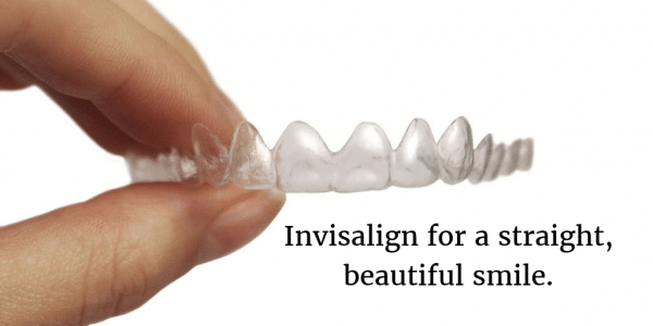 Invisalign Dentist - Burke, VA - Dr. Pamela Marzban