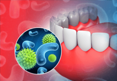 If you tooth hurts, it is time to go to the dentist. 