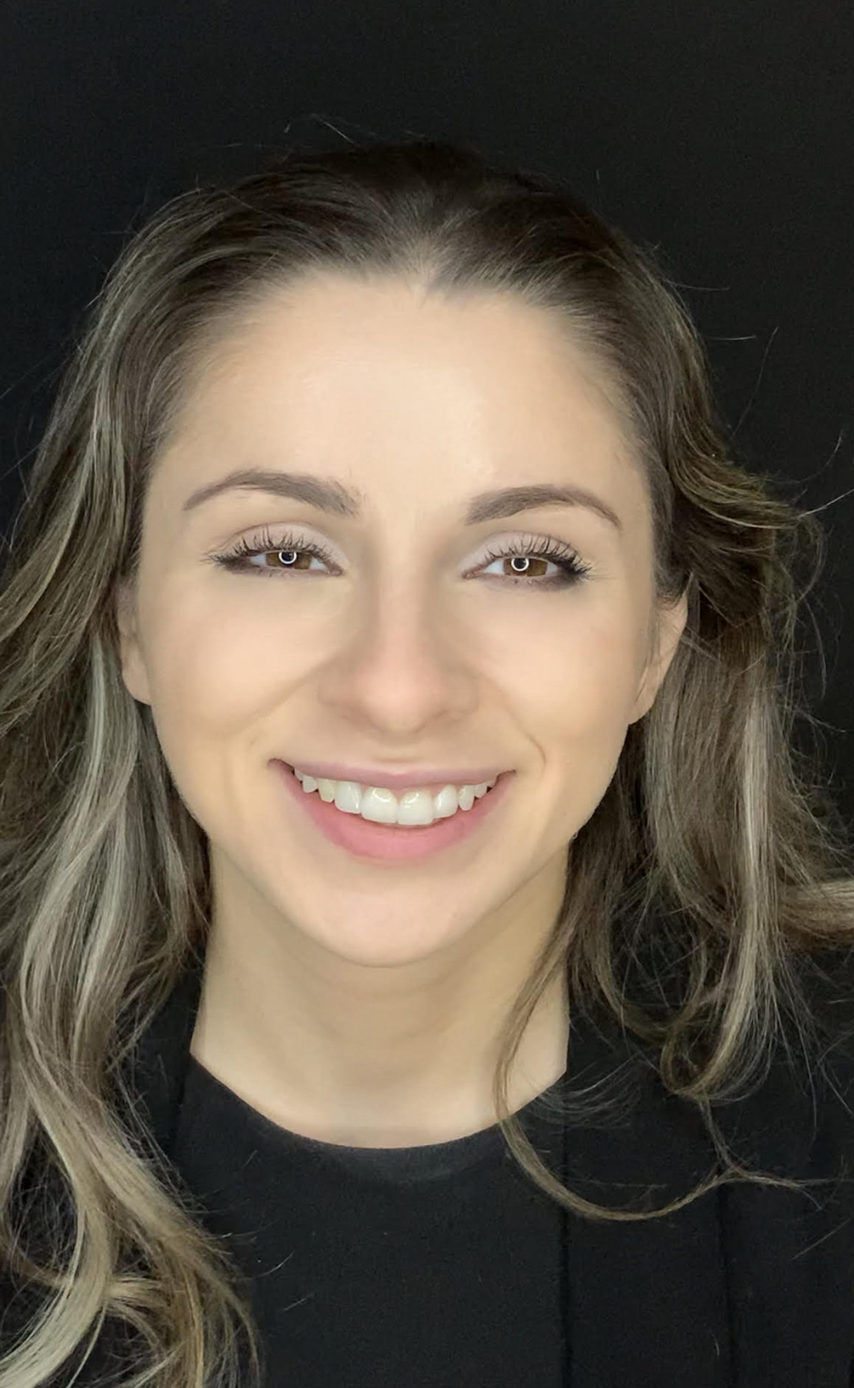 Why Do People Think Beautiful Teeth Are Attractive? porcelain veneers